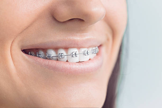 Best Teeth Whitening  in Lucas, TX